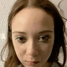 cam